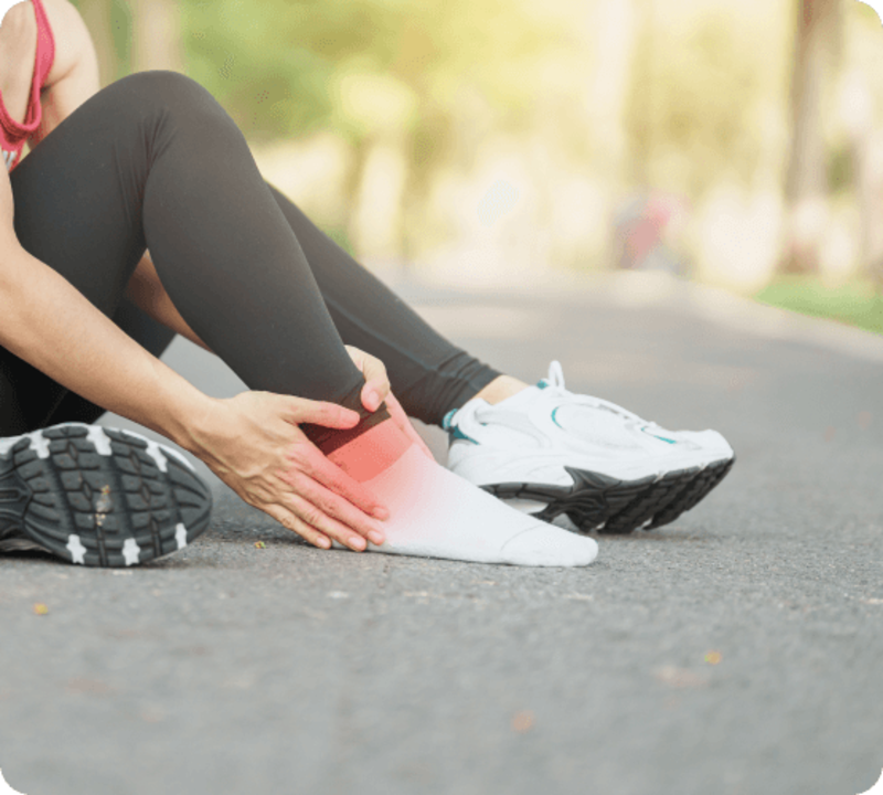 Ankle sprain severe